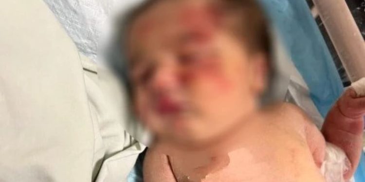 Cachorro de rua encontra bebê abandonada dentro de saco de lixo