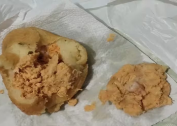 Mulher encontra dente humano em recheio de coxinha: 'Traumatizada'