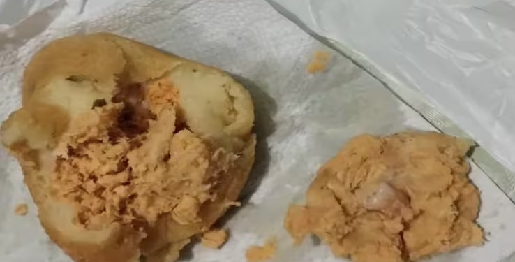 Mulher encontra dente humano em recheio de coxinha: 'Traumatizada'