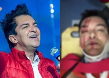 VÍDEO: Regis Danese sofre grave acidente e surge sangrando: “Orem por mim”