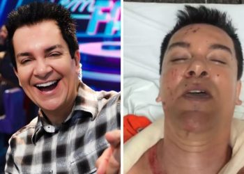 Regis Danese teve intestino perfurado e braço quebrado em acidente de carro