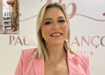 Dra. Ana Paula utiliza a ozonioterapia para eliminar gorduras indesejadas