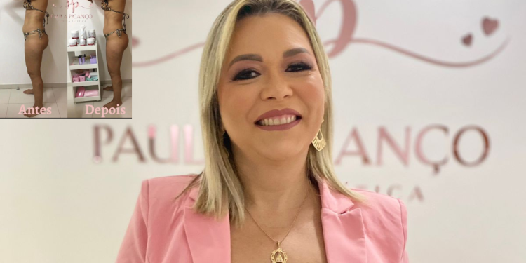Dra. Ana Paula utiliza a ozonioterapia para eliminar gorduras indesejadas