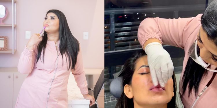Mitos e verdades: Dra. Eli Almeida esclarece tabus sobre o preenchimento labial
