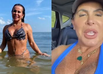 Gretchen recebe críticas após aparecer com pelos nos seios