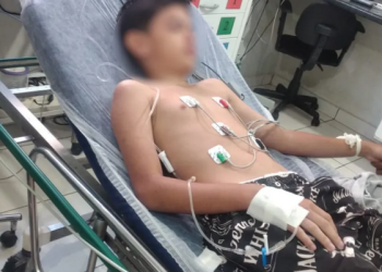 Um menino de 11 anos ficou internado após ser obrigado a comer uma lagartixa frita dada pela madrasta e pela mãe. Criança é