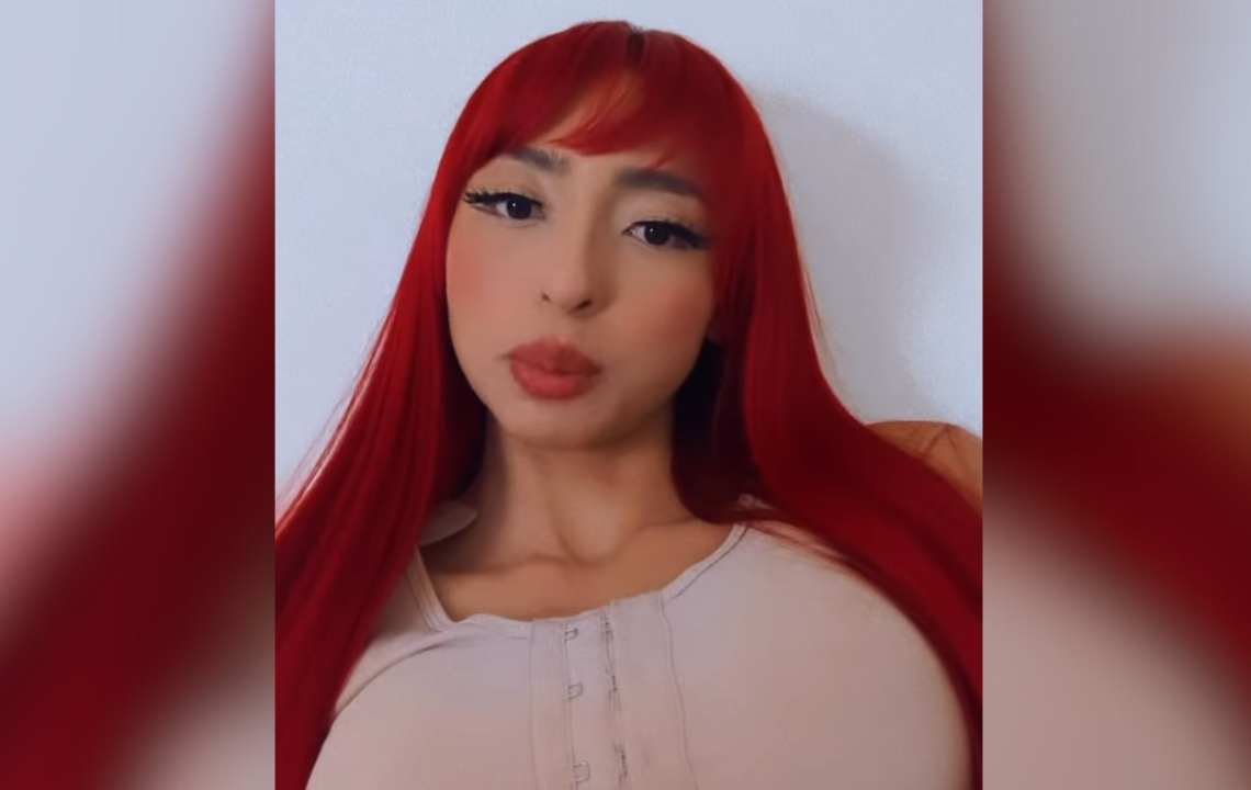 A influenciadora digital amazonense Ruivinha de Marte passou recentemente por uma cirurgia para colocar silicone. Ruivinha. Após colocar
