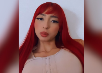 A influenciadora digital amazonense Ruivinha de Marte passou recentemente por uma cirurgia para colocar silicone. Ruivinha. Após colocar