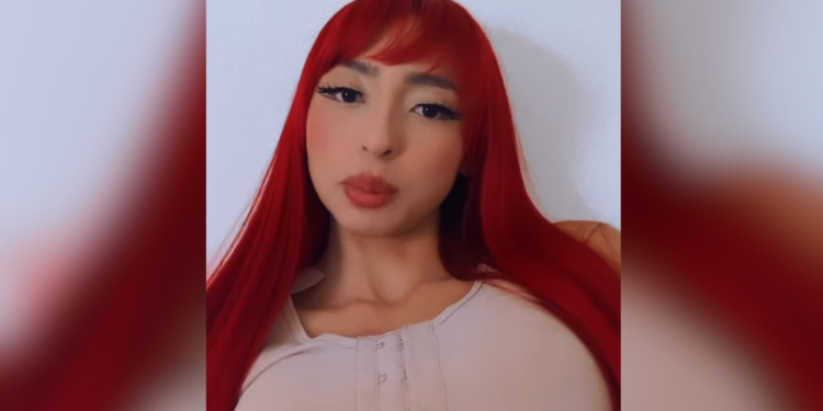 A influenciadora digital amazonense Ruivinha de Marte passou recentemente por uma cirurgia para colocar silicone. Ruivinha. Após colocar