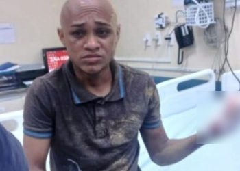 Conhecido da polícia, ‘Neguinho’, tem os dedos decepados após roubo frustrado