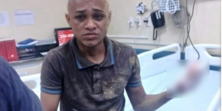 Conhecido da polícia, ‘Neguinho’, tem os dedos decepados após roubo frustrado