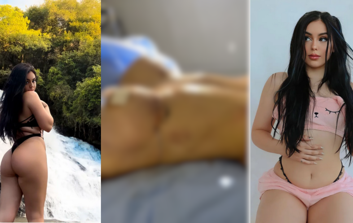 Bella Angel, a irmã de MC Melody, de 16 anos, anunciou na última terça-feira (7), que se submeteu a três cirurgias plásticas. Aos 18