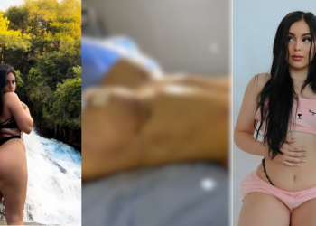 Bella Angel, a irmã de MC Melody, de 16 anos, anunciou na última terça-feira (7), que se submeteu a três cirurgias plásticas. Aos 18