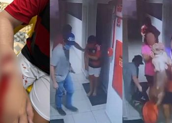 Vídeo mostra criança sendo atacada por pitbull em condomínio