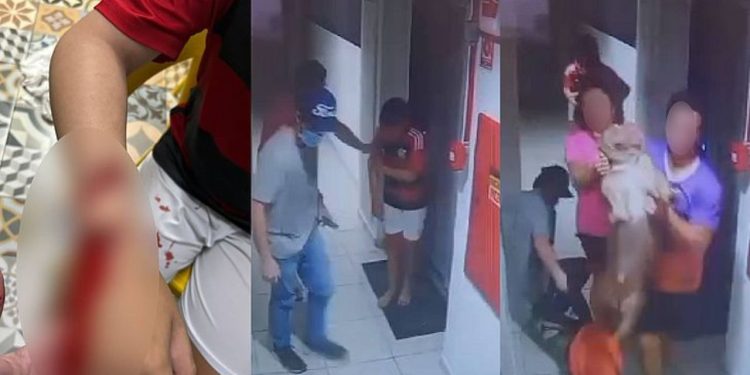 Vídeo mostra criança sendo atacada por pitbull em condomínio