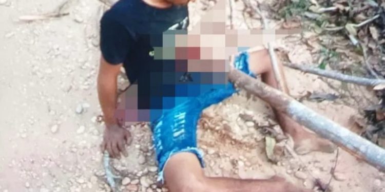 O jovem Igor Silva de Oliveira, de 20 anos, sofreu um grave acidente de motocicleta e ficou com um tronco de árvore atravessado. Jovem sofre