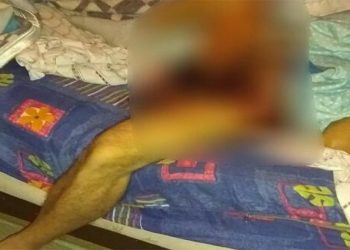 Esposa descobre traição, corta o pênis do marido e joga na privada
