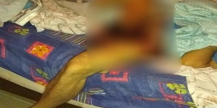 Esposa descobre traição, corta o pênis do marido e joga na privada