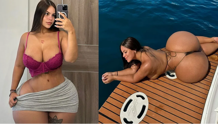 A modelo Gracie Bon optou por utilizar suas redes sociais como plataforma para destacar as condições. Modelo com