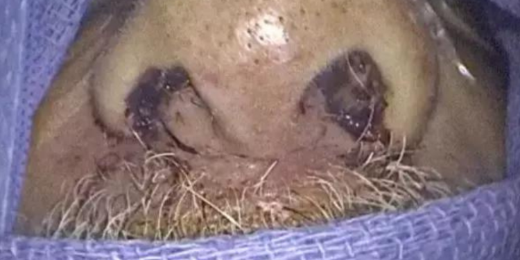 Um homem procurou o hospital após sentir o rosto e lábios inchados e ao fazer exames foi constatado que. Chocante: