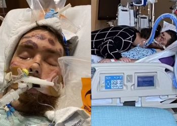 Pelo encravado na virilha deixa homem em coma