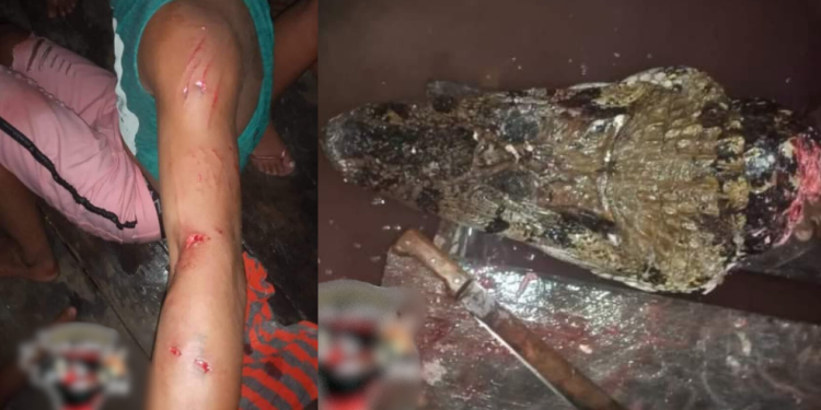 Jacaré ataca ribeirinho durante banho de rio