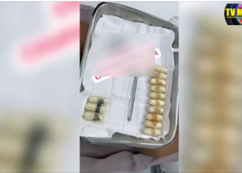 RECHEADA – Médicos retiram cápsulas de drogas dentro do estômago de mulher no 28 de Agosto