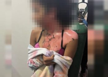 Vídeo mostra tia jogando água quente na sobrinha de 14 anos por ciúmes do marido