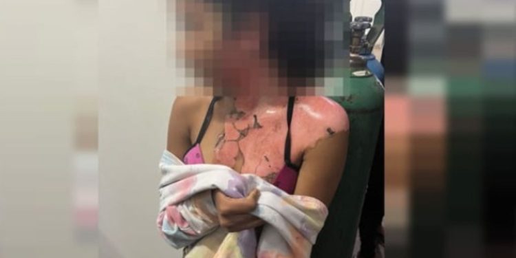 Vídeo mostra tia jogando água quente na sobrinha de 14 anos por ciúmes do marido