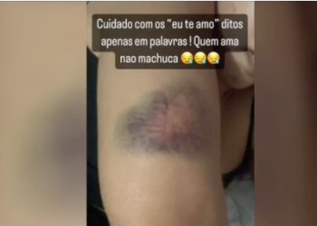 MANAUS – Cantora sofre tentativa de feminicídio e namorado lutador de MMA é o suspeito