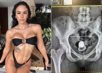 Durante o primeiro encontro sexual com um parceiro, Alicia Davis passou por uma experiência bizarra. Atriz