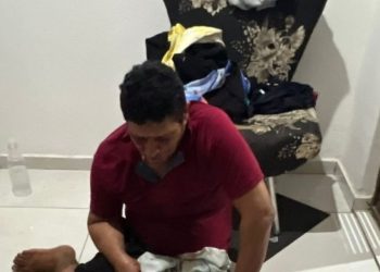 Imagens fortes mostram homem que arrancou os próprios olhos após sair da igreja ouvindo vozes