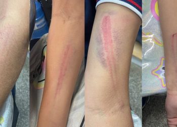 A polícia prendeu a mãe e o padrasto de uma adolescente de 15 anos que foi espancada pelo casal no dia. Presos