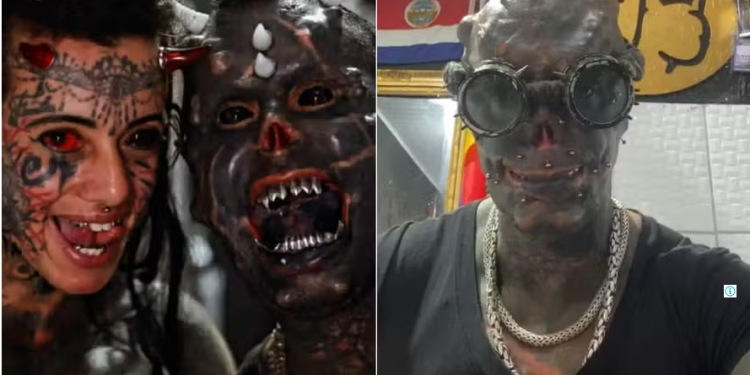 Diabão Praddo, influenciador digital e uma das pessoas com mais modificações corporais no mundo, anunciou. Vídeo: