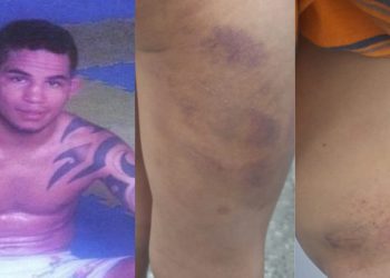 José Matheus Oliveira Gomes, 31, o ‘Justin’, foi preso nesta terça-feira (2), após espancar com uma ripa o. Preso