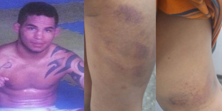 José Matheus Oliveira Gomes, 31, o ‘Justin’, foi preso nesta terça-feira (2), após espancar com uma ripa o. Preso