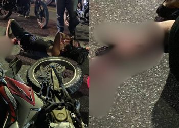 Um motociclista que não teve o nome divulgado, ficou com uma fratura exposta na perna após ser. Em Manaus.