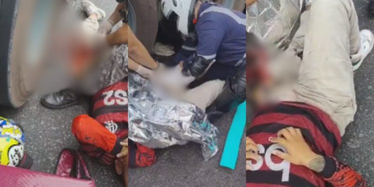 Vídeo forte mostra motociclista que ficou com a perna rasgada após acidente no bairro Aleixo