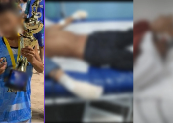 Um menino de aproximadamente 10 anos teve os dedos das mãos cortados, por membros de facção criminosa. Criança