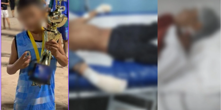 Um menino de aproximadamente 10 anos teve os dedos das mãos cortados, por membros de facção criminosa. Criança