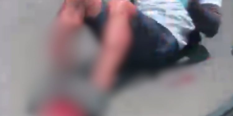 veja como ficou a perna do motociclista que colidiu contra carro na Avenida das Torres