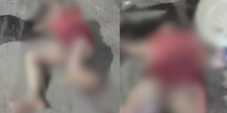 Mulher tem o pé arrancado após ser atropelada por motociclista na Compensa