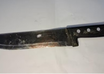 Mulher é presa por cortar p%nis do marido após ele ‘falhar na hora H’