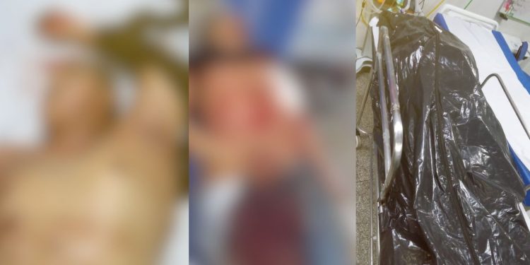 Veja como ficou o trio que tentou atirar em policiais em comunidade de Manaus