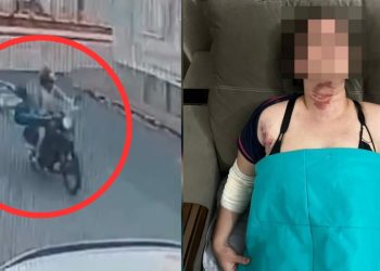 Vídeo: fio solto corta pescoço e derruba mulher da garupa de moto