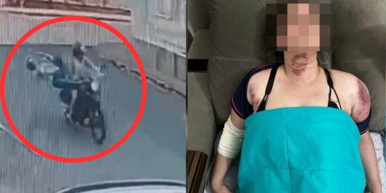 Vídeo: fio solto corta pescoço e derruba mulher da garupa de moto