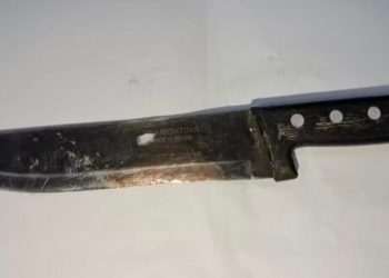 Mulher é presa por cortar partes íntimas do marido após FALHAR na hora H