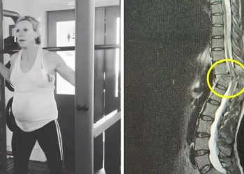 A professora de educação física, Henrietta Paxton, ficou paraplégica após um trágico acidente durante um. Professora