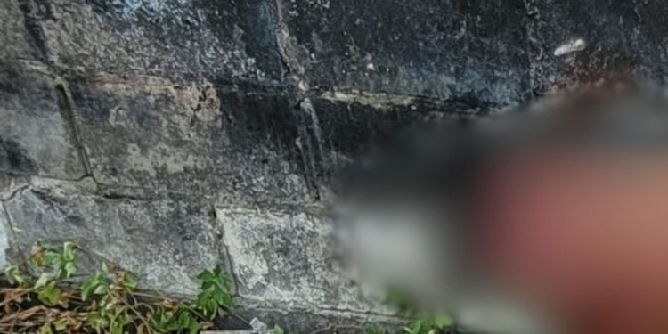 Veja como ficou o morador de rua que punido com a morte por roubar fios em Manaus