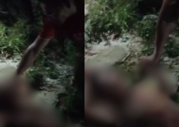 Após ser baleado no rosto em Manaus, suposto assaltante recebe oração e aceita Jesus